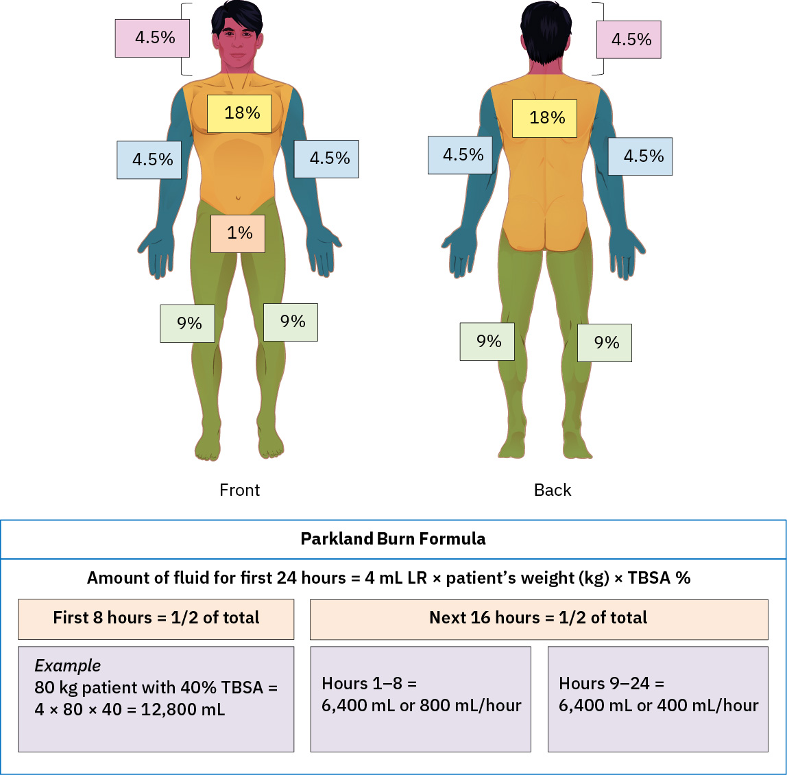 TBSA 매핑과 첫 24시간 수액 일정을 포함한 Parkland 화상 공식