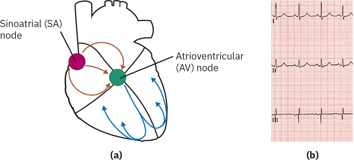 대표 ECG 파형 맥락과 함께 나타낸 SA-to-AV 전도 경로