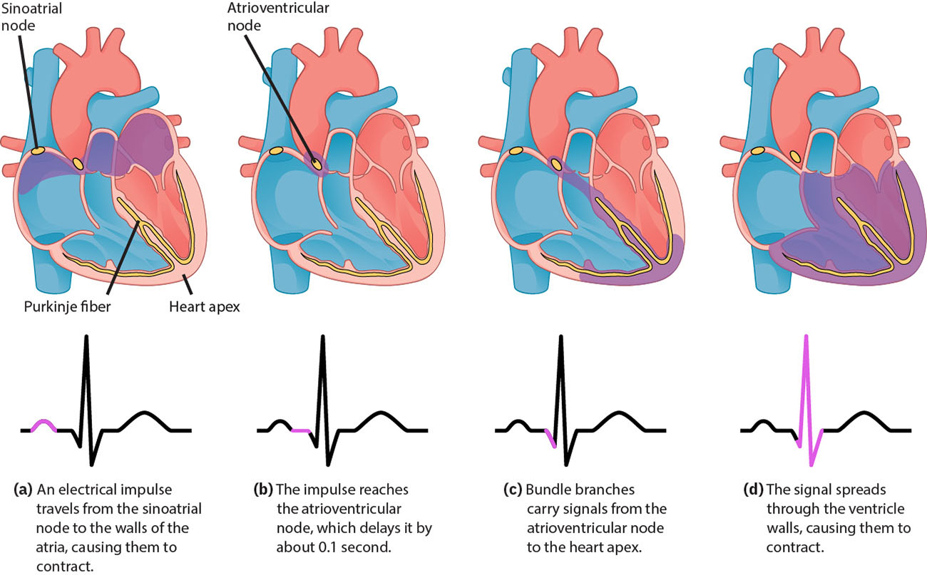 SA 결절에서 AV 결절 및 각분지로 이어지는 심장 전도 순서와 ECG 편위의 연관