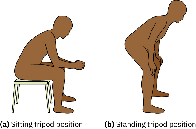 호흡곤란에서 호흡 작업량을 줄이기 위해 사용되는 앉은 자세 및 선 자세 tripod 체위 양상