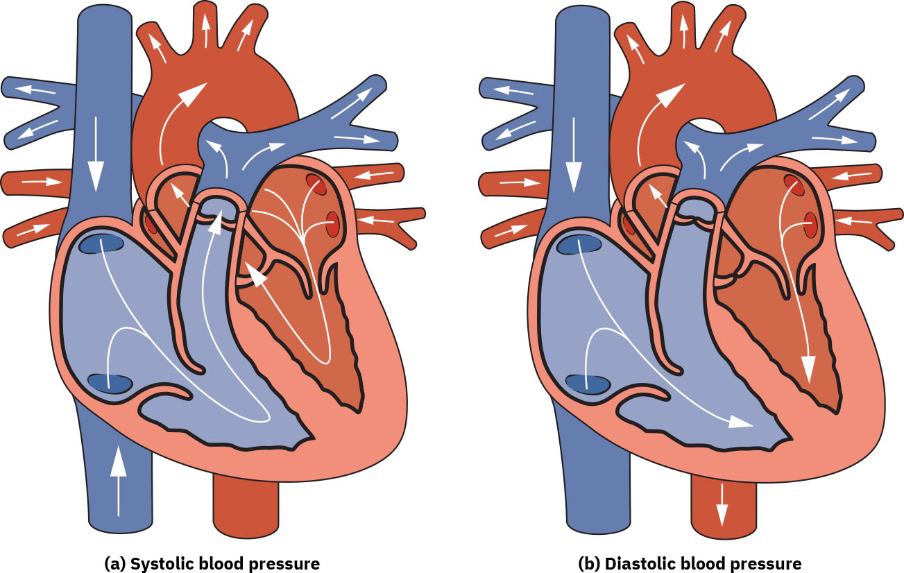 혈압 해석에 사용하는 수축기 박출과 이완기 충만 단계를 보여주는 심장 혈류 비교
