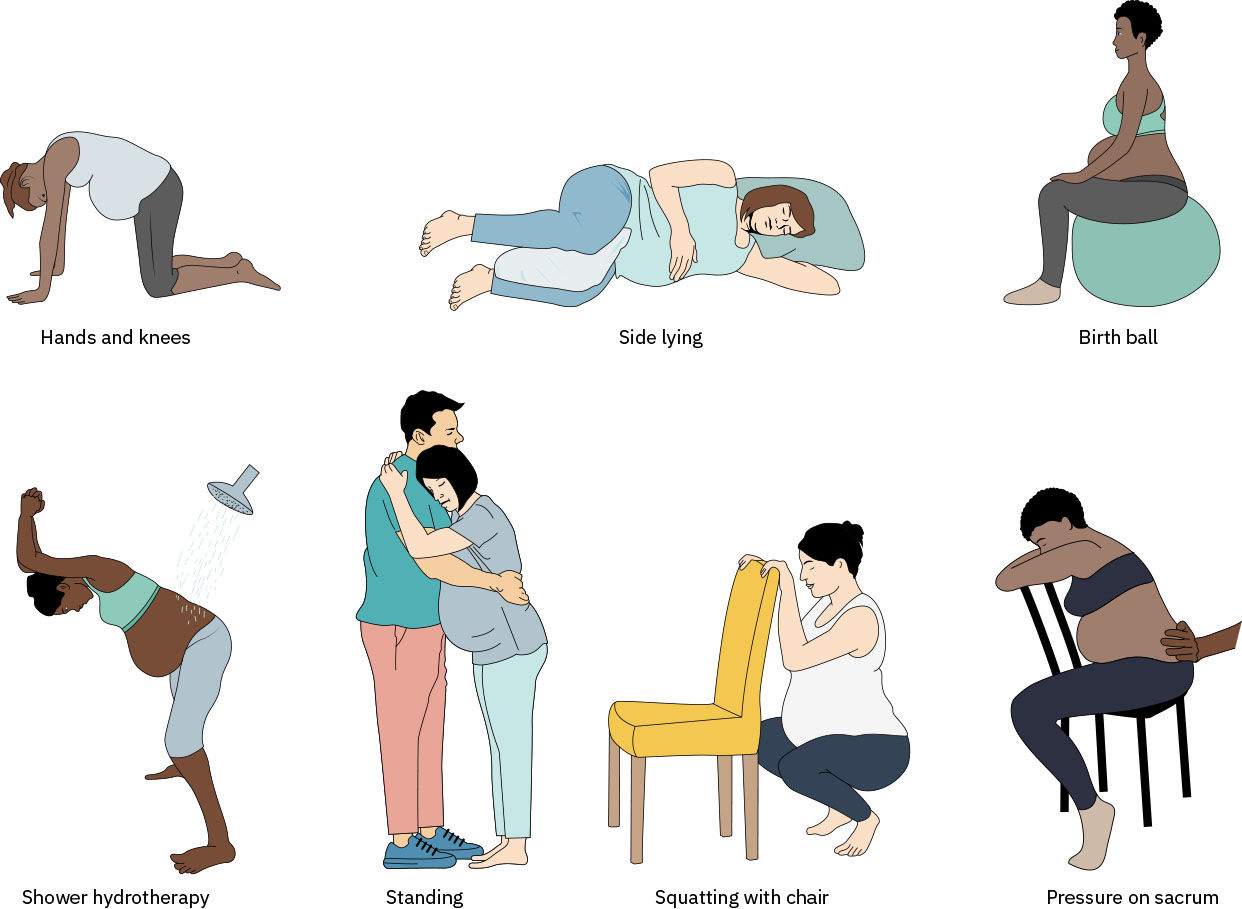 hands-and-knees, 측위, 출산 볼, 수치료, 서서 지지, 스쾃 지지, 천골 counterpressure를 포함한 분만 안위 체위 예시
