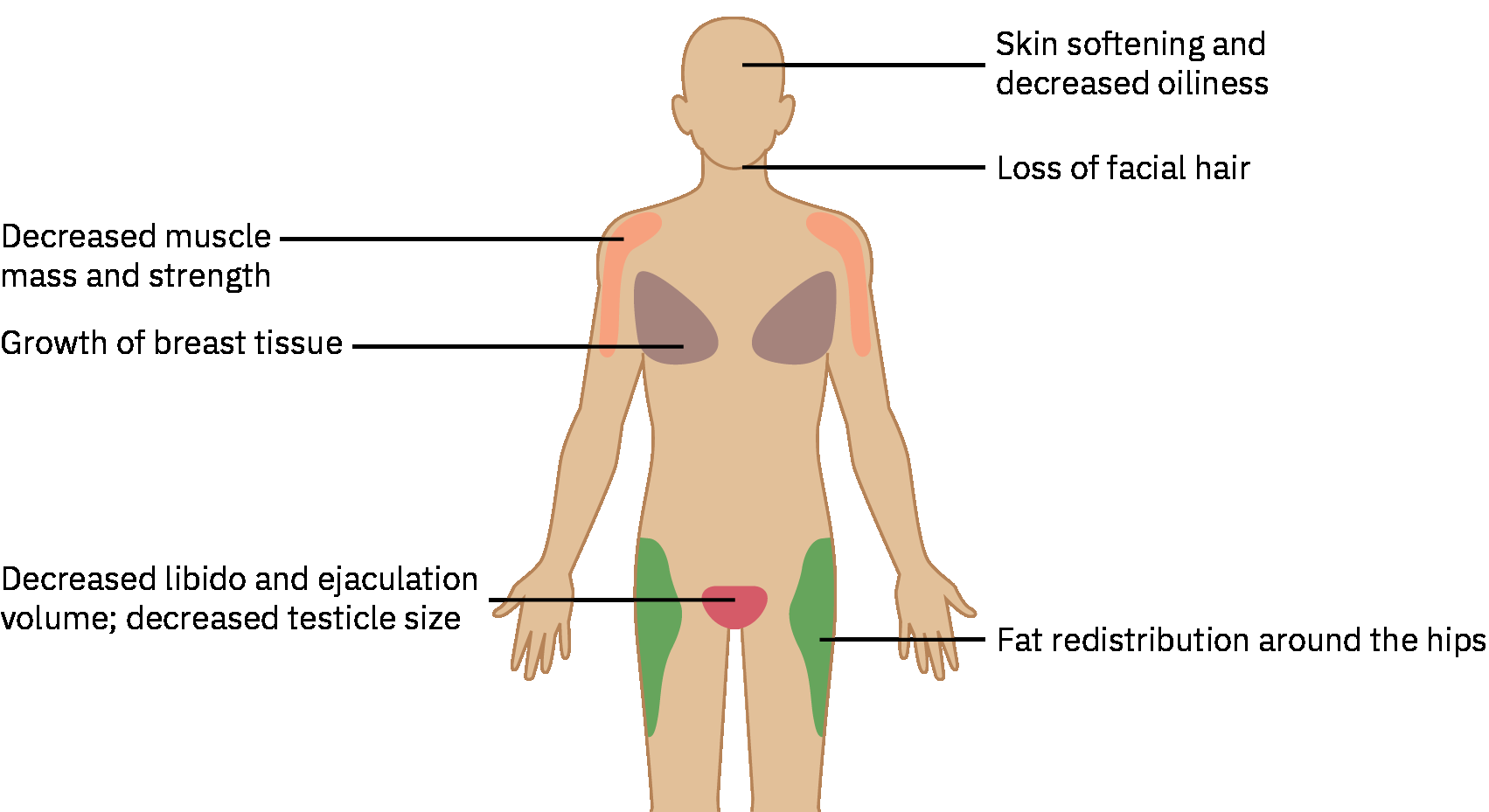 여성화 호르몬 치료의 시간 경과에 따른 예상 신체 변화