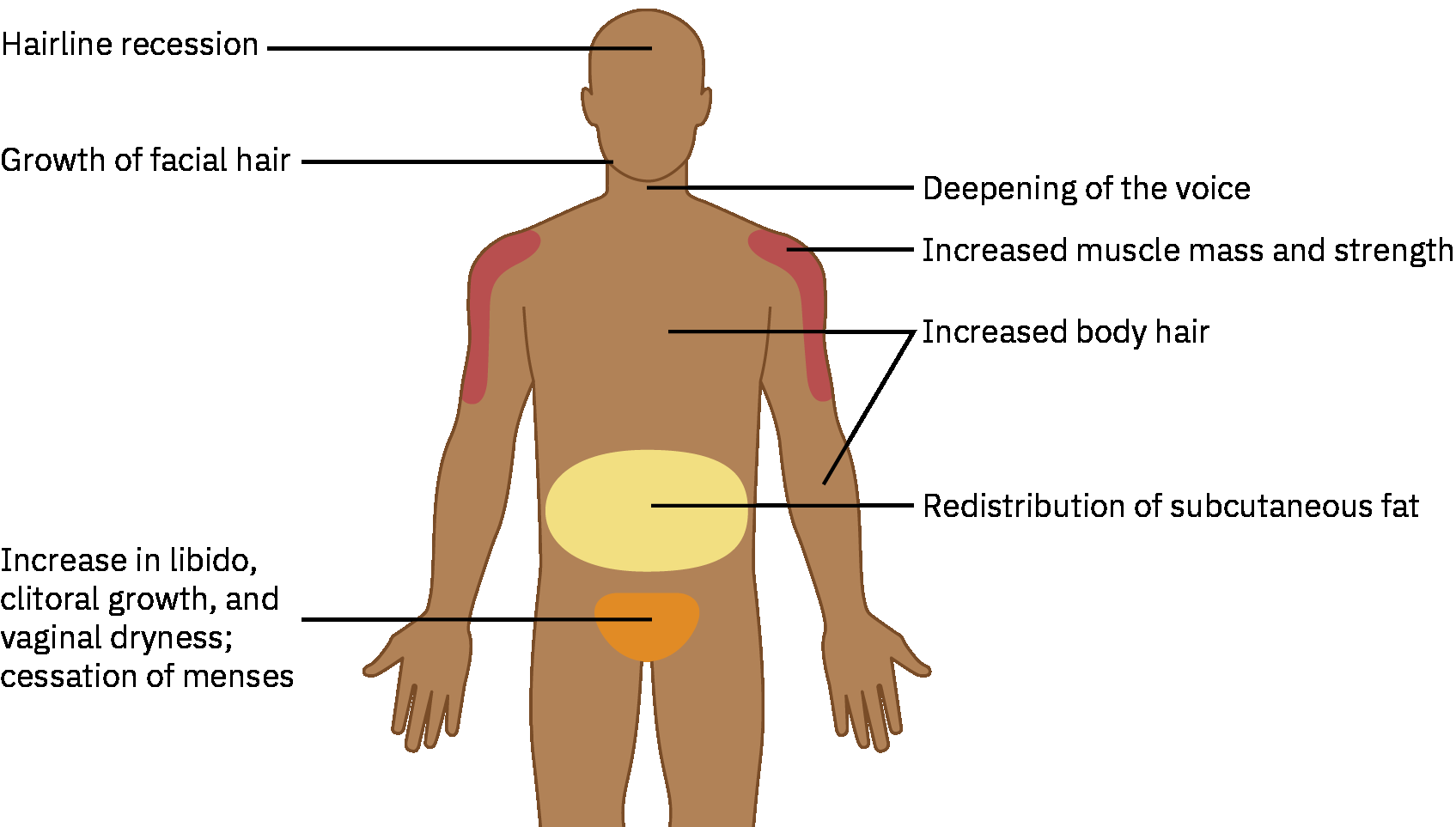 남성화 호르몬 치료의 시간 경과에 따른 예상 신체 변화