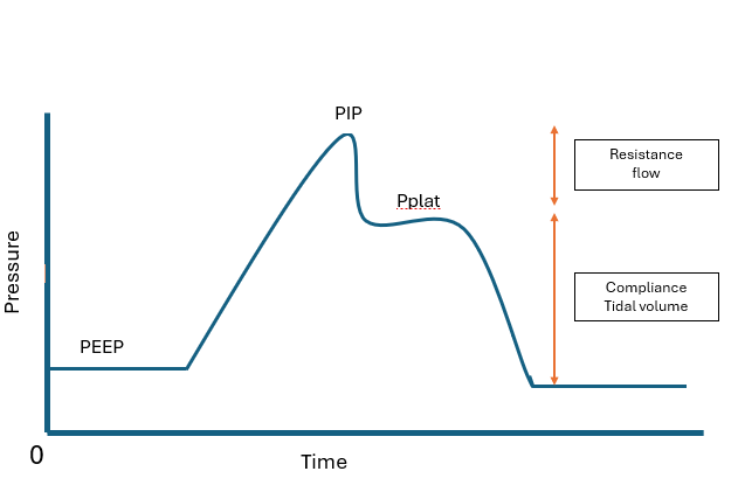 저항-순응도 해석 단서를 포함한 PIP, plateau pressure, PEEP의 pressure-time 파형